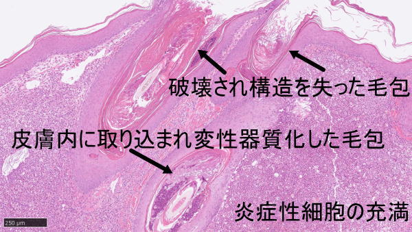 皮膚組織検査所見